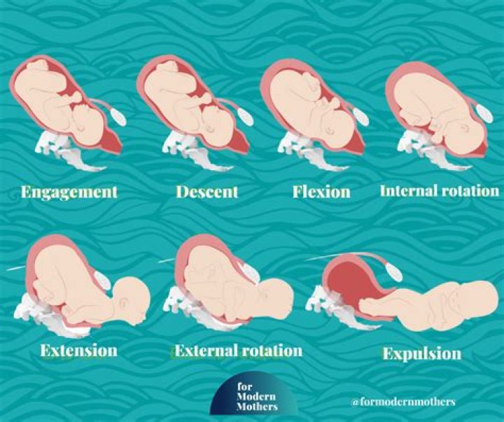 Do we get loose motions in pregnancy?