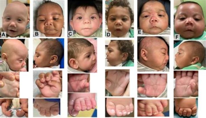 How are babies born with deformities?