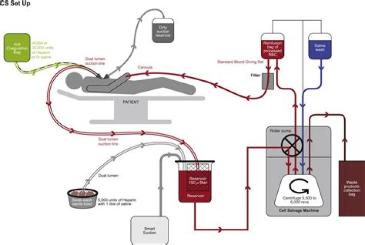 How does salvaging work in eve?