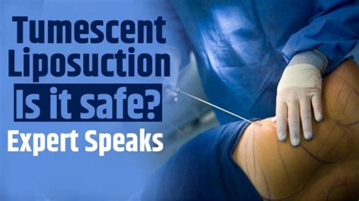 Is tumescent liposuction safe?