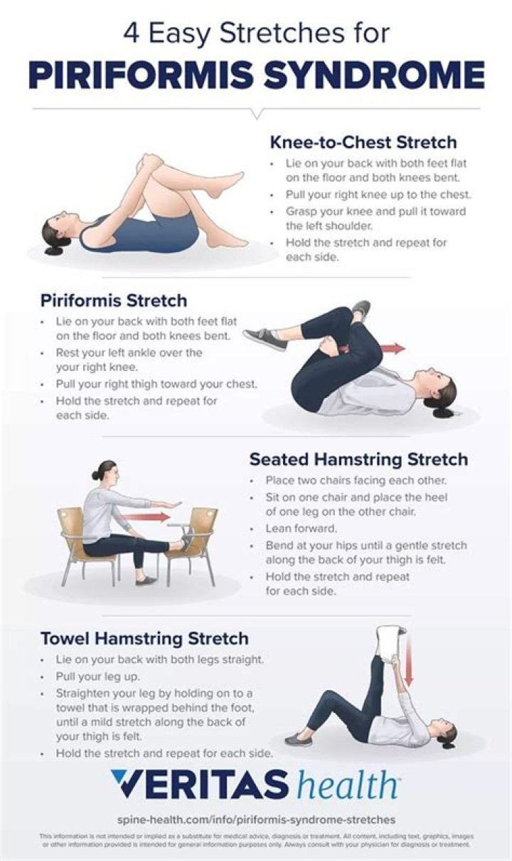 Should you stretch piriformis syndrome?
