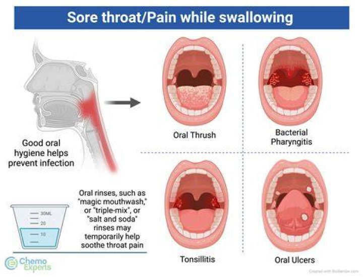 What is the jiggly thing in the back of your throat?