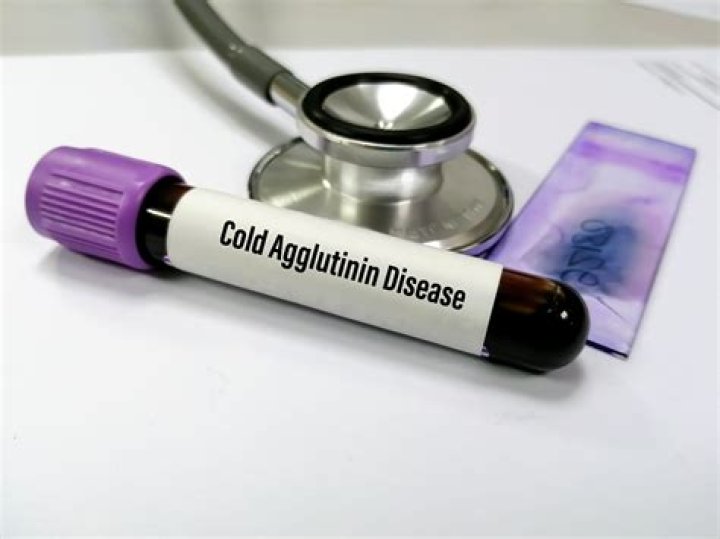 Whats a cold agglutinin test?