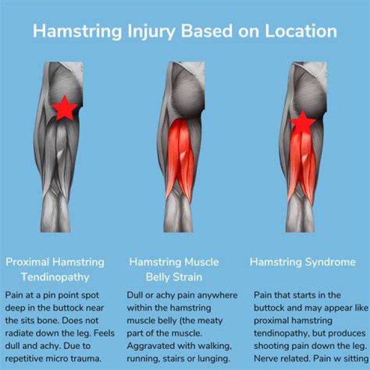 Whats a hamstring injury?